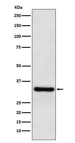 Pituitary homeobox 3 Ab