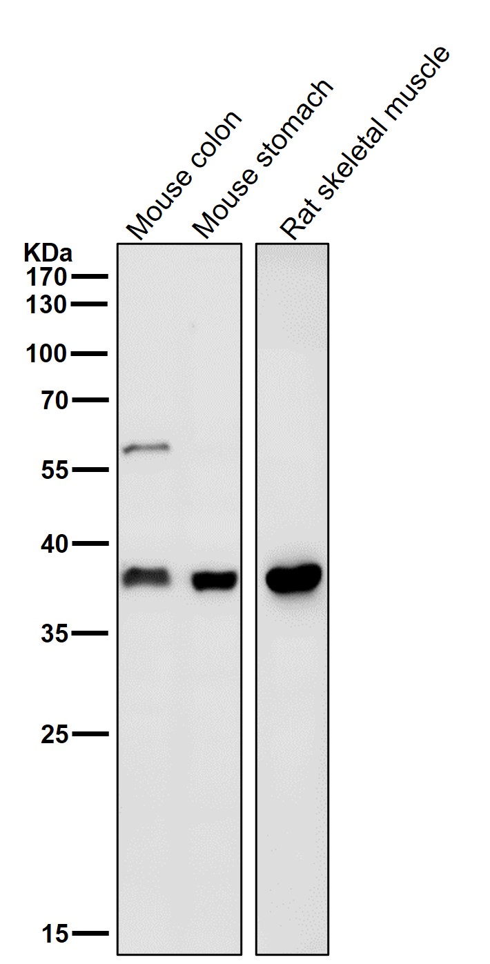 FBXO32 Ab