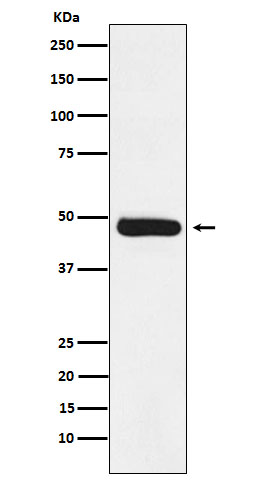 ERCC8 Ab