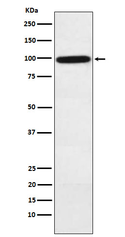 Complement factor B Ab