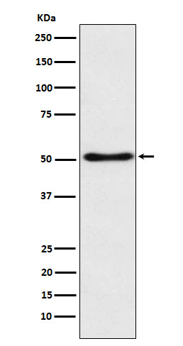 SFRP 4 Ab