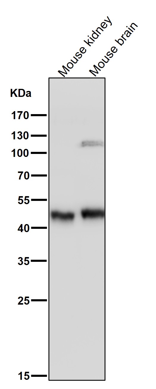 SFRP 4 Ab