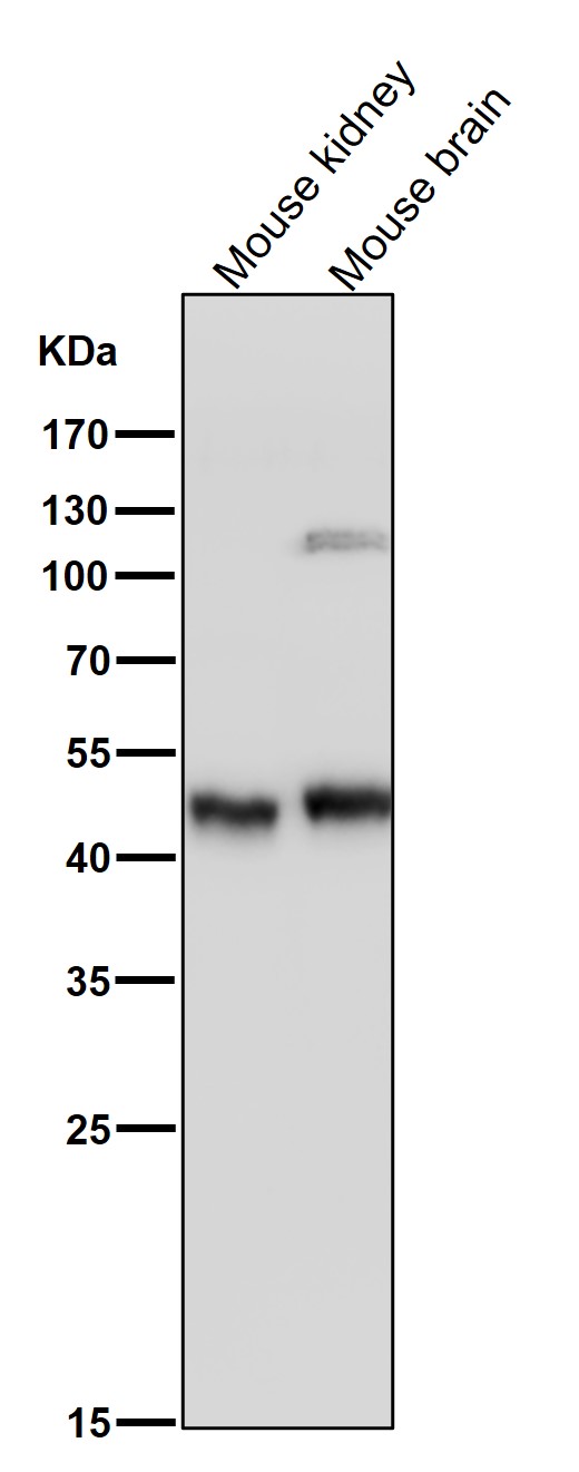 SFRP 4 Ab