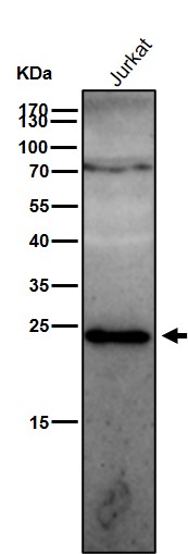 GSTP1 Ab