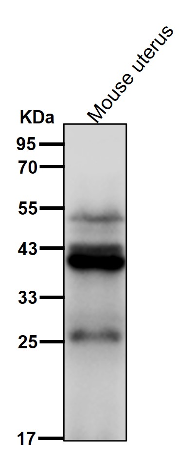 HSD3B1 Ab