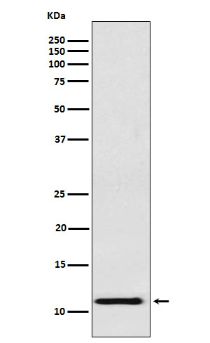 Hemoglobin gamma 1/2 Ab