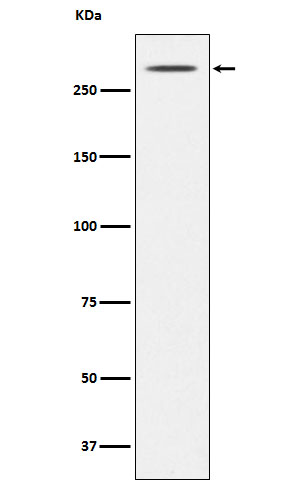 Thyroglobulin Ab