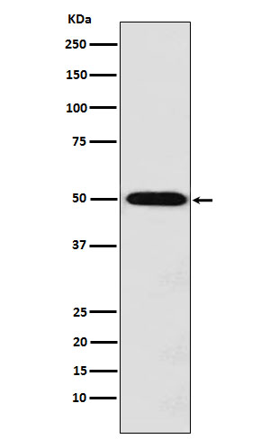 MCT 1 Ab