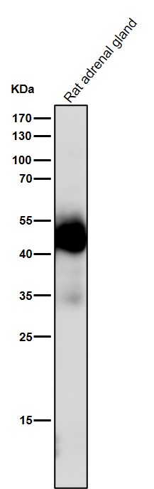 Uroplakin 3a Ab