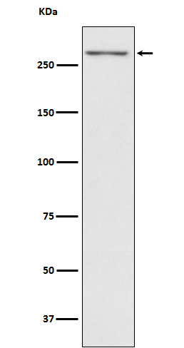 Thyroglobulin Ab