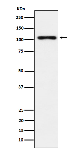 Thyroid peroxidase Ab