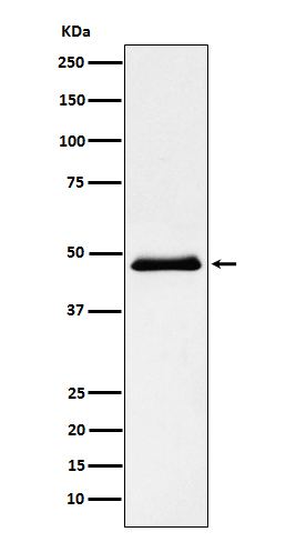 Pancreatic lipase Ab