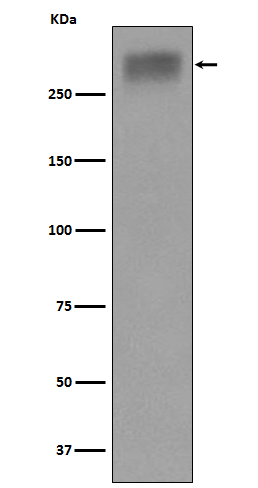 Thyroglobulin Ab