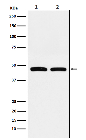 Squalene synthase Ab