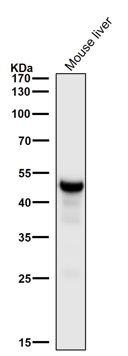 Squalene synthase Ab