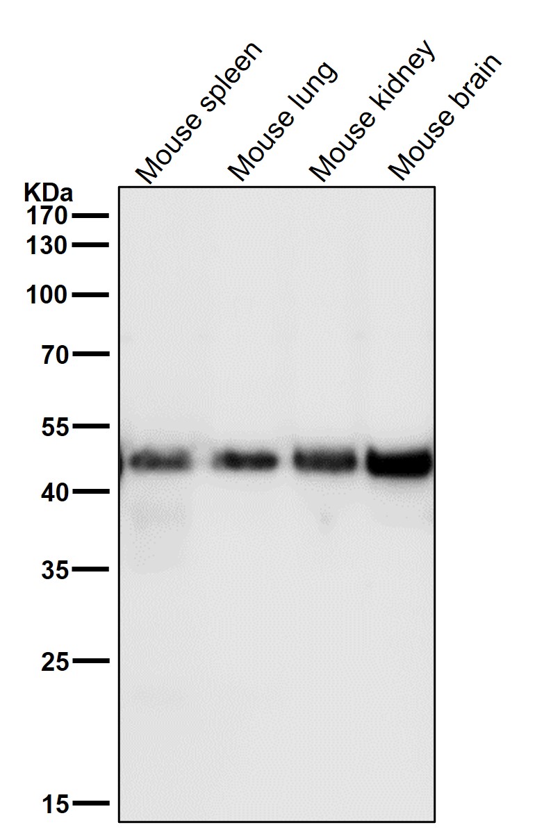 Squalene synthase Ab