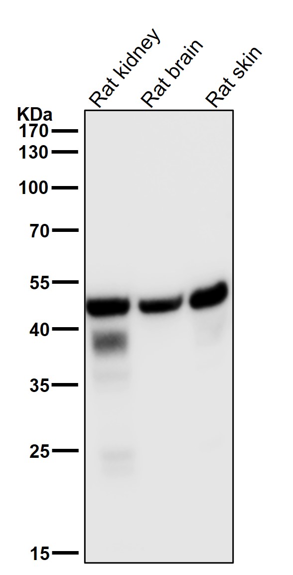 Squalene synthase Ab