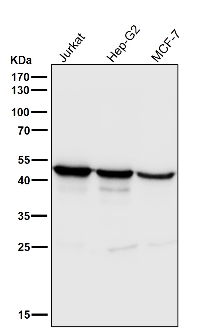 Squalene synthase Ab