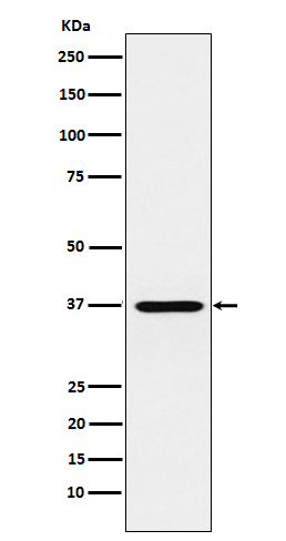 Cone rod homeobox protein Ab