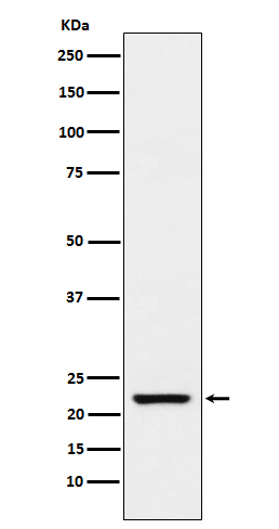 Transgelin Ab