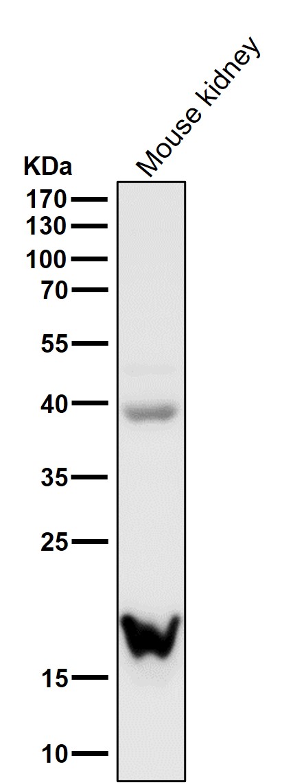 Transgelin Ab