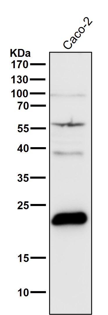 Transgelin Ab