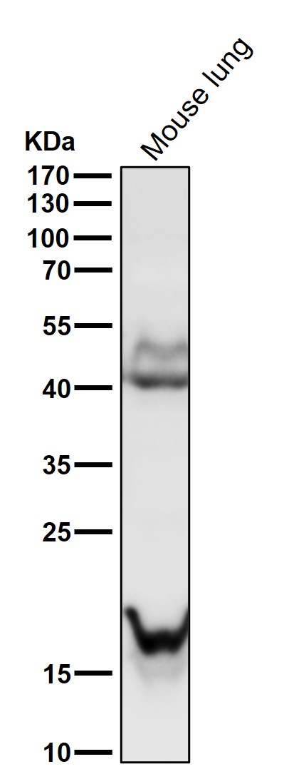 Transgelin Ab