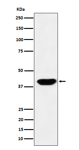 Islet 1 Ab