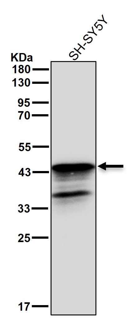 Islet 1 Ab