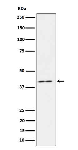 IL 18BP Ab