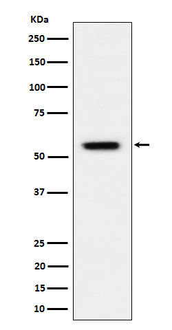 p-Vimentin (S39) Ab