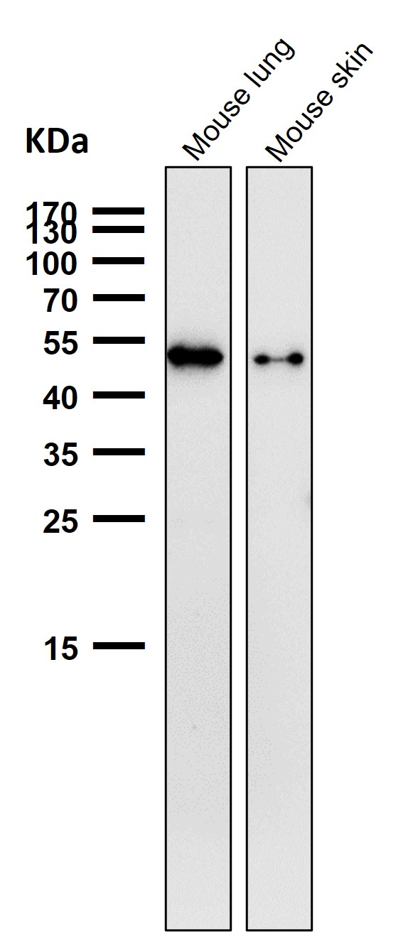 p-Vimentin (S39) Ab