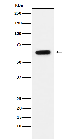 Estrogen receptor Ab