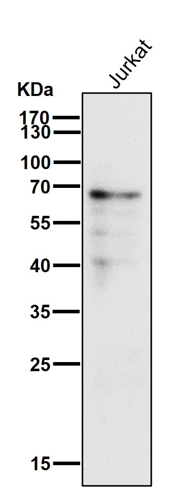 Estrogen receptor Ab