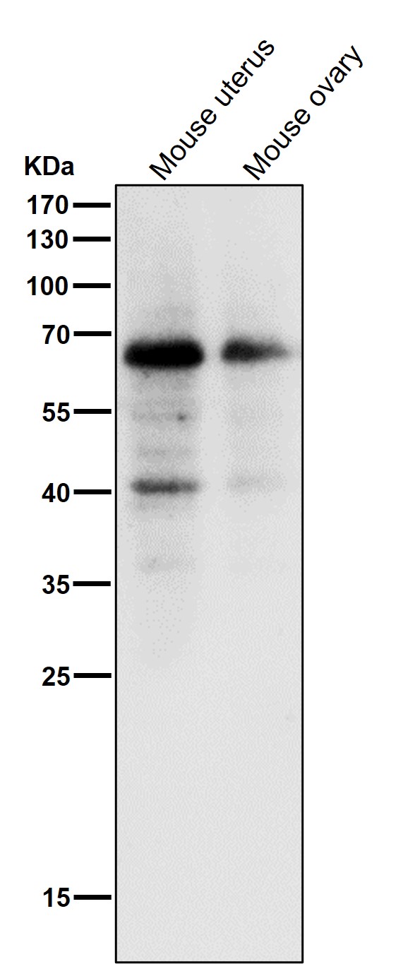 Estrogen receptor Ab