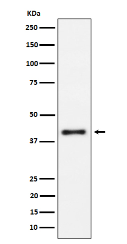 IL 15 receptor alpha Ab