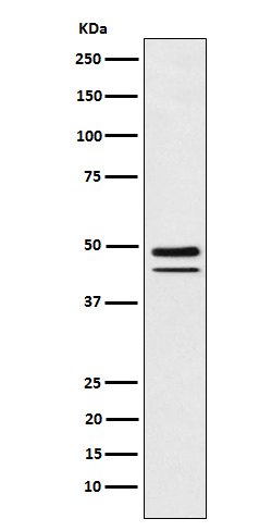 Protein T Ab