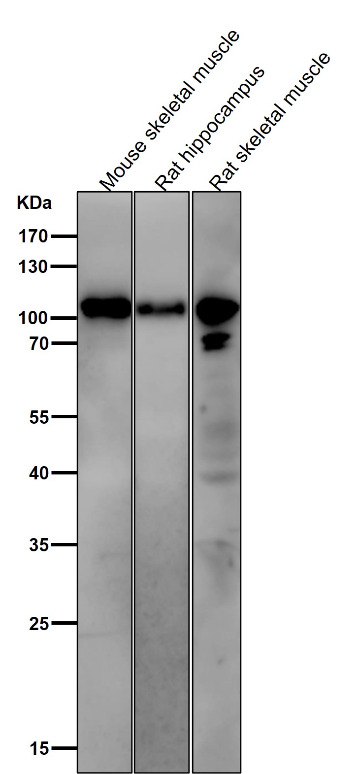 p-GluR1 (S831) Ab