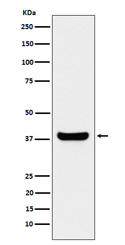 PPP1B Ab