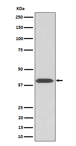 p-PKA C alpha/beta/gamma (T197) Ab