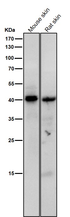 p-PKA C alpha/beta/gamma (T197) Ab