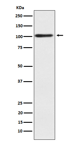 alpha Actinin 2 Ab