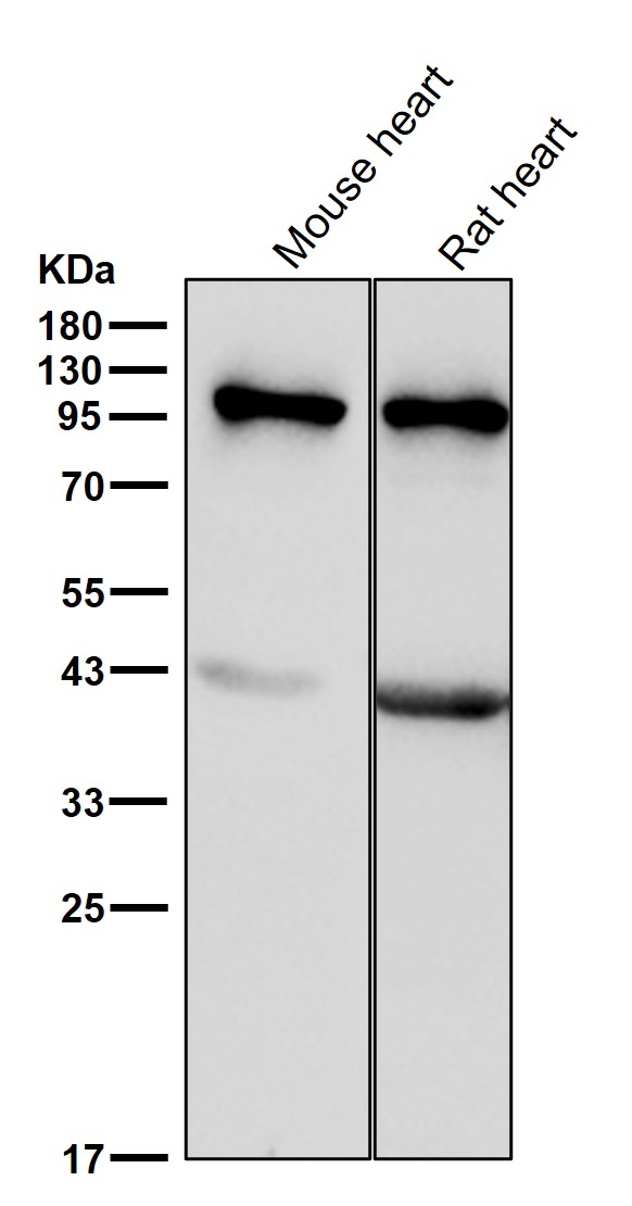 alpha Actinin 2 Ab