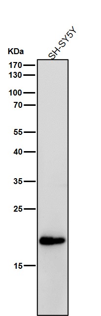 C reactive protein Ab