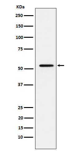 MMP1 Ab