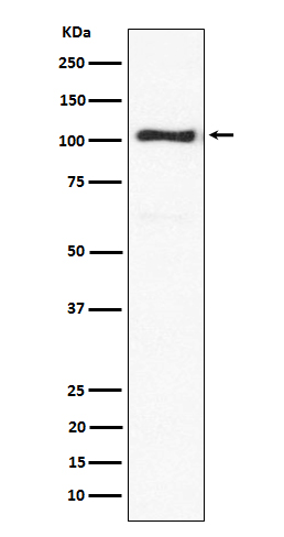 alpha Actinin 3 Ab