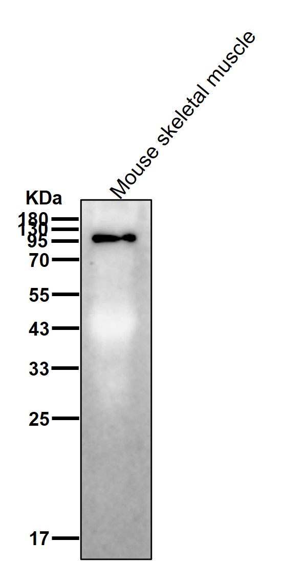 alpha Actinin 3 Ab