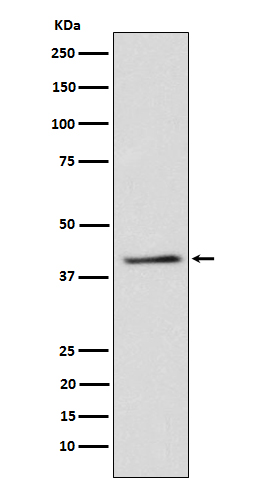 TRIB3 Ab