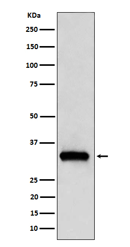 NDUFAF1 Ab