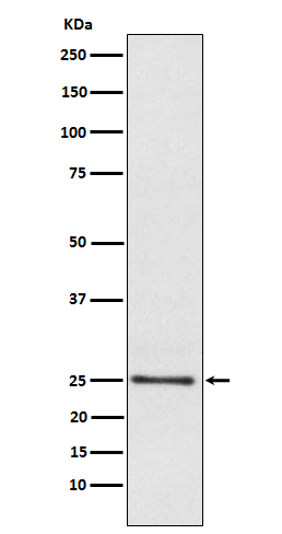 Lysophospholipase 1 Ab